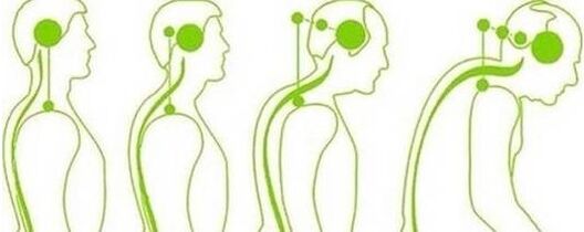 The vertine spine loses mobility